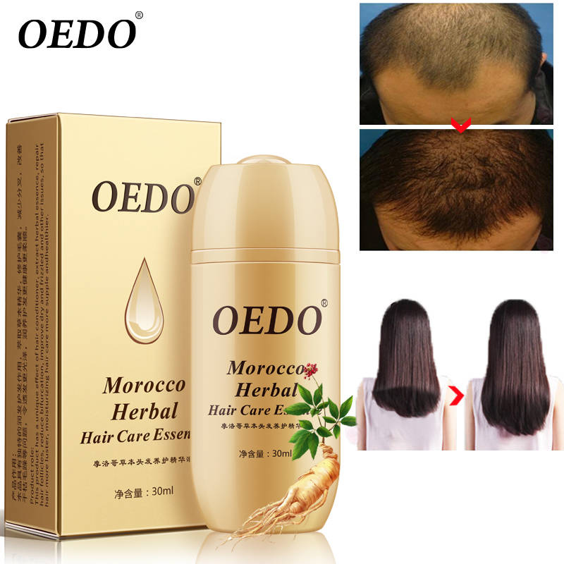 Марокко травяные женьшень Уход за волосами сущность лечения Для мужчин t для Для мужчин и Для женщин потерю волос быстро мощный рост волос Сыворотки ремонт корни волос