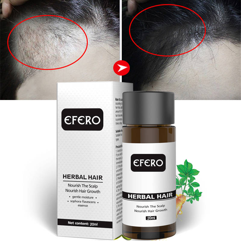 Эфирные масла Efero для ухода за волосами, сыворотка для защиты от выпадения волос, мощный уход за здоровьем, уход за волосами TSLM2
